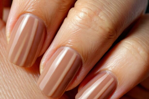 Rillen auf den Fingernägeln: Ursachen, Behandlung und Prävention